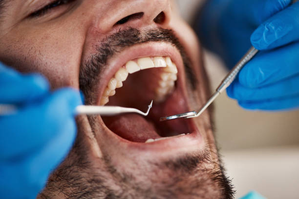 Best Emergency Tooth Extraction in Waterville, ME